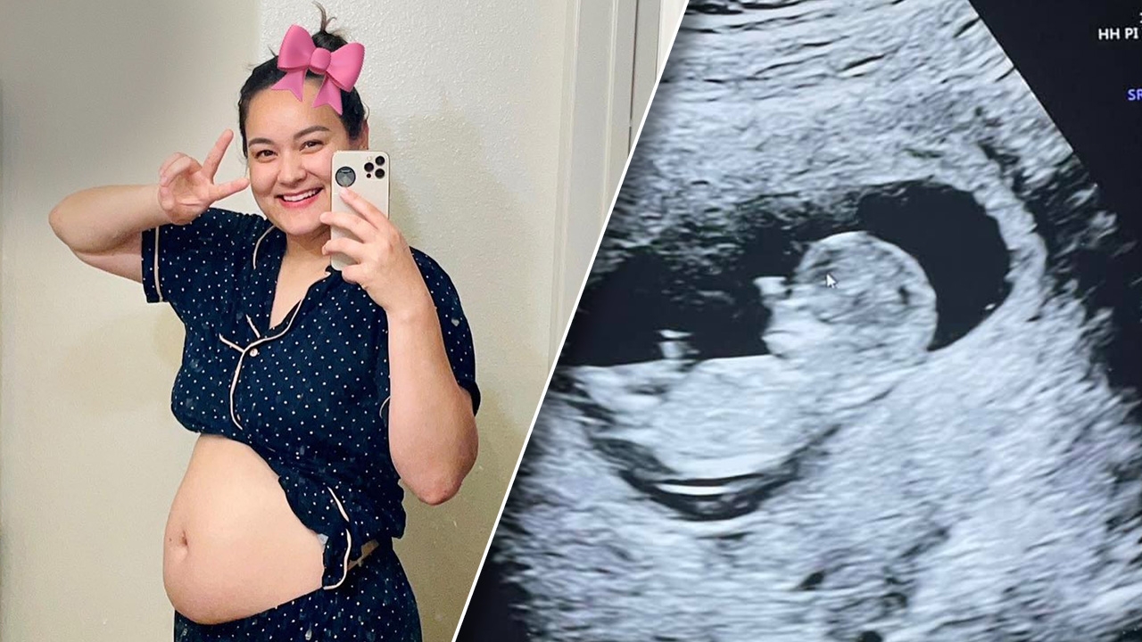 นาตาลี เดวิส เฉลยเพศลูกคนที่ 2 หลังตั้งครรภ์ 3 เดือน ท้องใหญ่เร็วมากแม่