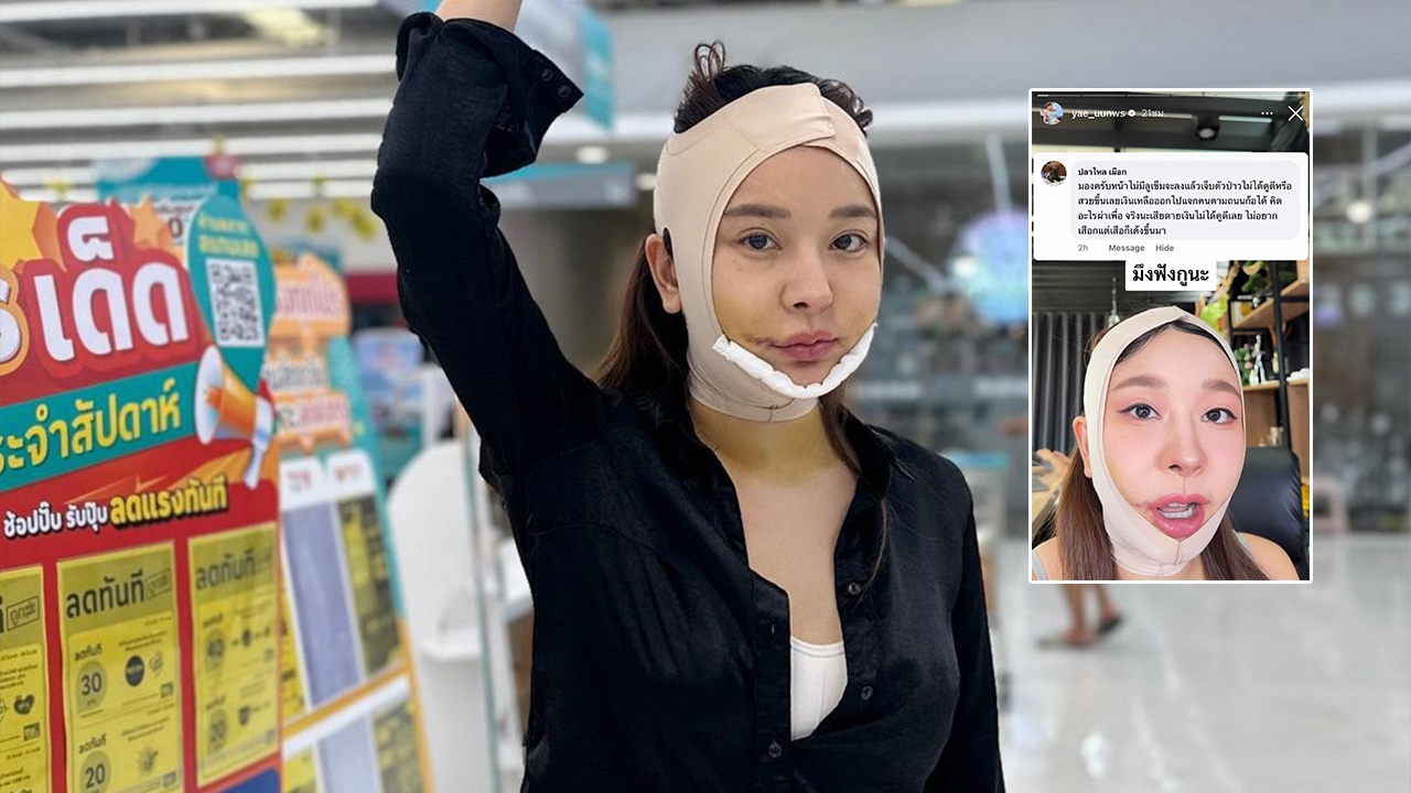 หญิงแย้ นนทพร เจ้าแม่ศัลยกรรม โดนแซะแรง หน้าใหม่ไม่ดูสวยขึ้นเลย 