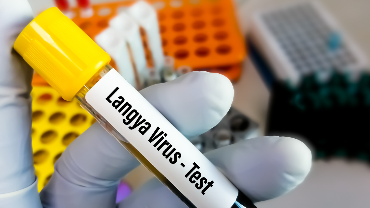 ไวรัสแลงยา เชื้อสายพันธุ์ใหม่ ถูกคาดระบาดแทนที่โควิด-19 ในอนาคต