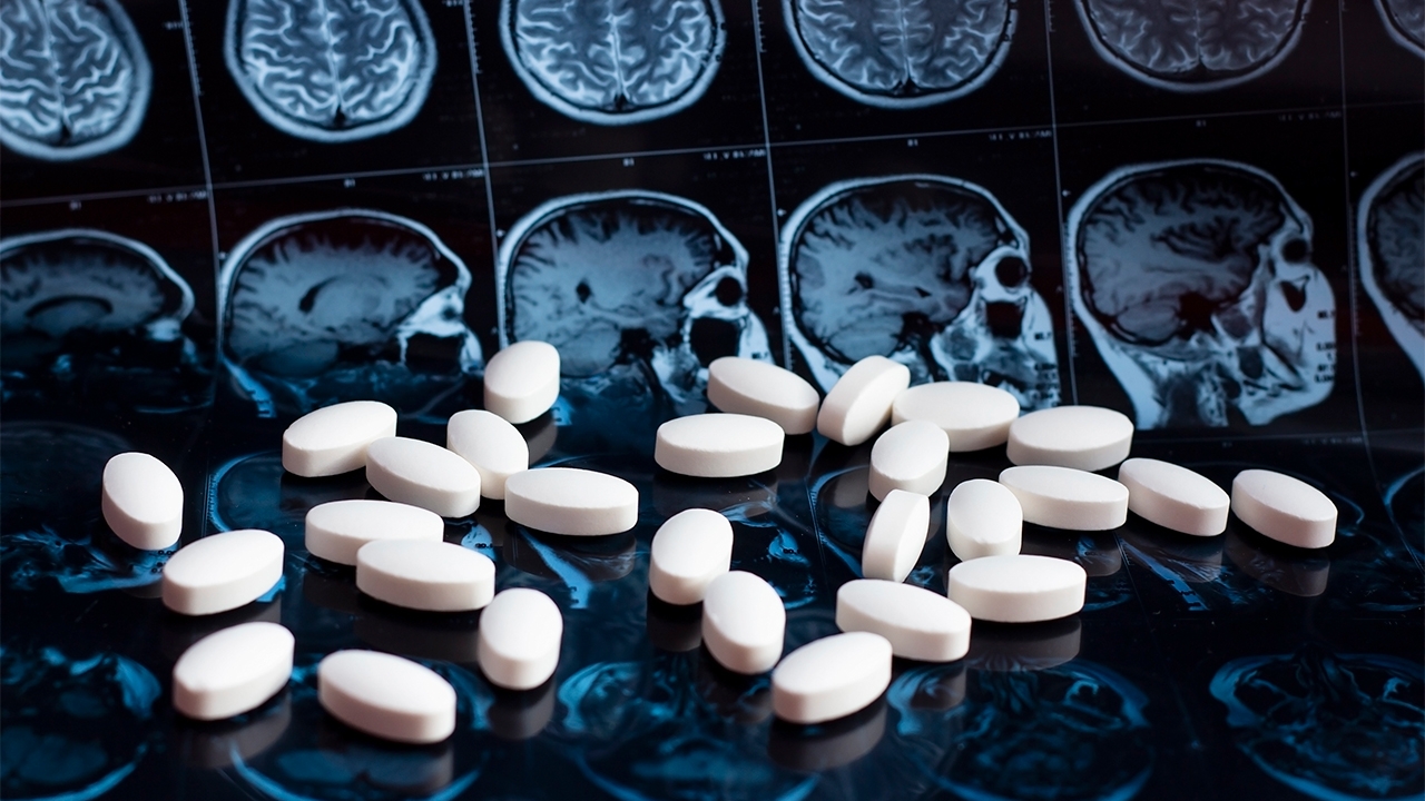 อนุมัติยาชะลออัลไซเมอร์