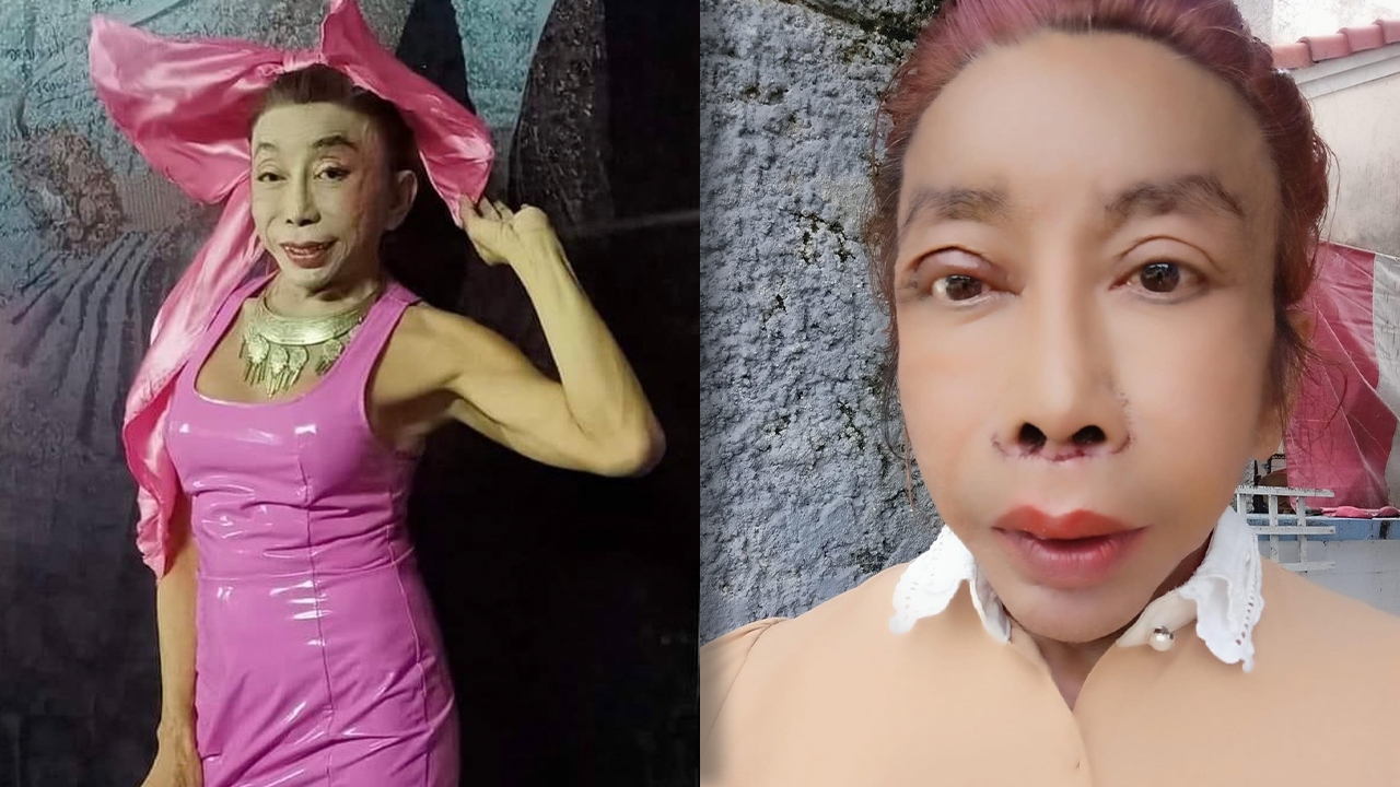 เปิดหน้าใหม่ สิตางศุ์ บัวทอง หลังทำศัลยกรรม จนชาวเน็ตพูดเป็นเสียงเดียวกัน