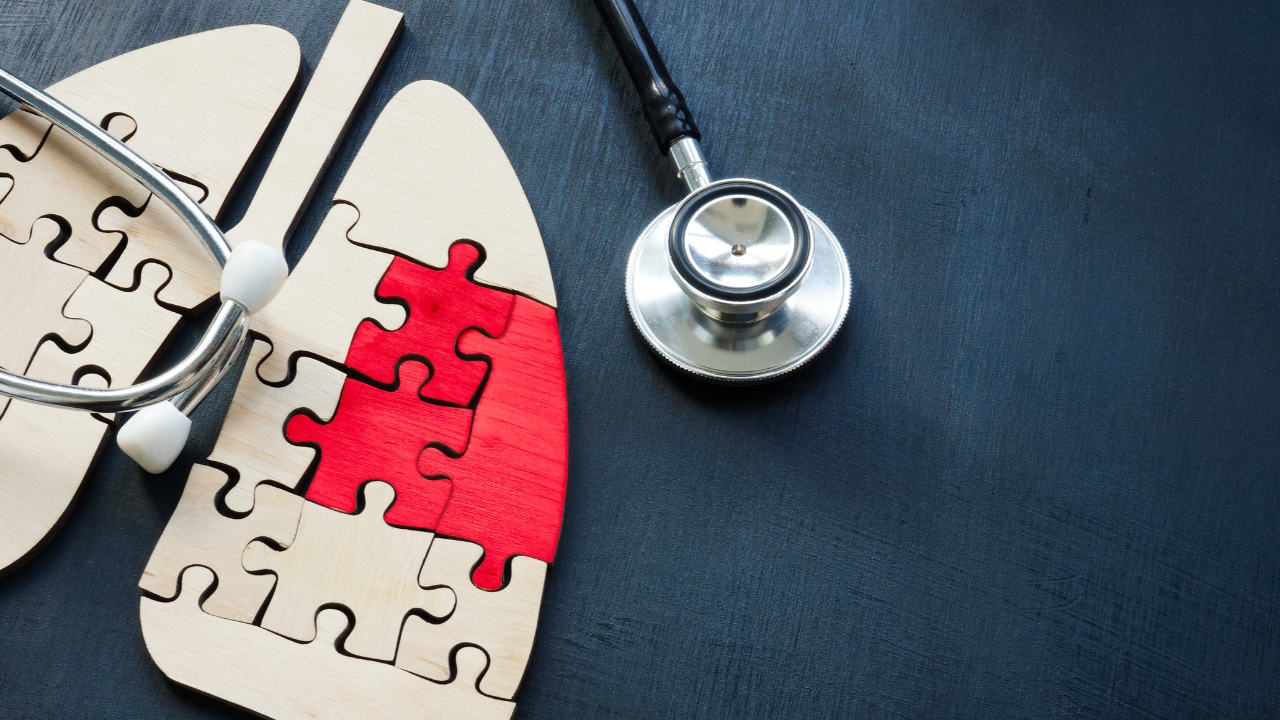 มะเร็งปอด รักษาได้ไหม มีวิธีไหนบ้าง