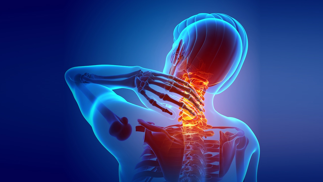 "หมอนรองกระดูกคอเสื่อม" ทับเส้นประสาท โรคของคน ติดโต๊ะทำงาน