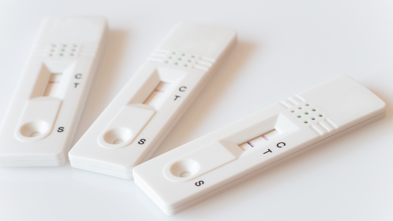 "หมอยง" เผยมีผู้ป่วยหลายราย ติดเชื้อ "โควิด-19" พร้อมกับ "ไข้หวัดใหญ่"