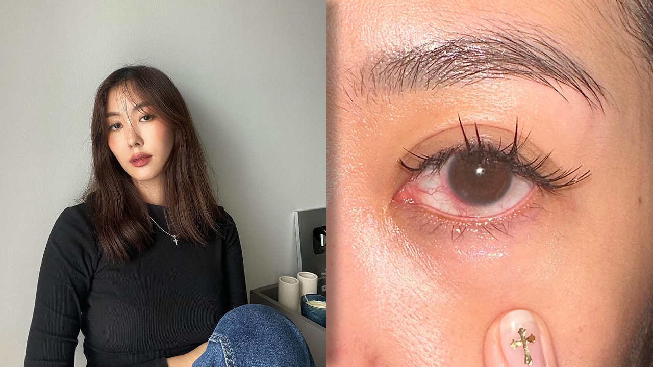 ยิปโซ เตือนเป็นอุทาหรณ์ ต่อขนตาแต่ได้แผลครูดและกระจกตาติดเชื้อ