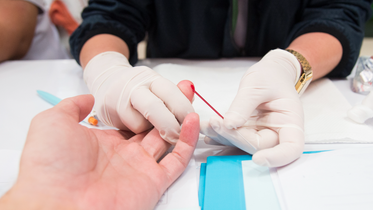 ตรวจ HIV ฟรีปีละ 2 ครั้ง ช่วยลดความเสี่ยงจากโรคฝีดาษลิง รับสิทธิได้ที่ไหนบ้าง