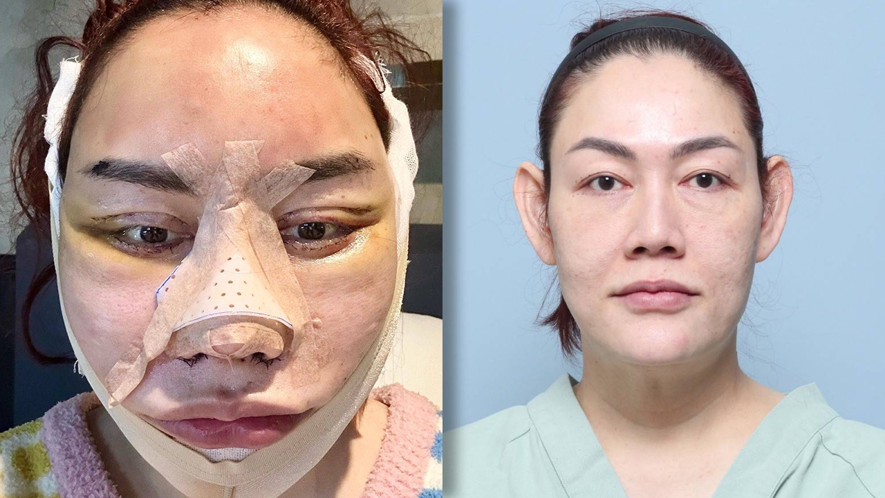 ตะลึงมาก ผู้จัดการดารามือทอง ตัดสินใจทุบหน้าใหม่ 12 ชม. ตอนนี้สวยปังมากแม่