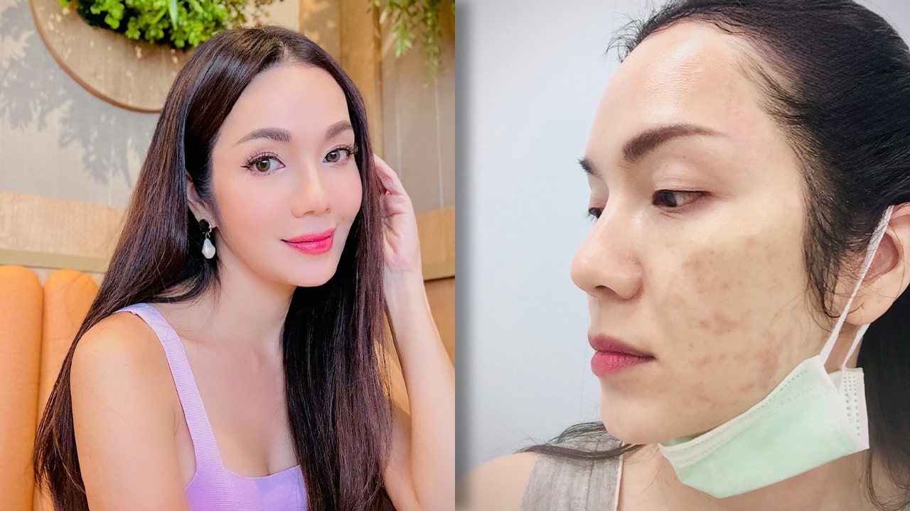 อ๋อม สกาวใจ เครียดหนักหน้าพัง สูญเงินหลักล้าน โดนเทงาน-ไม่กล้าออกบ้าน