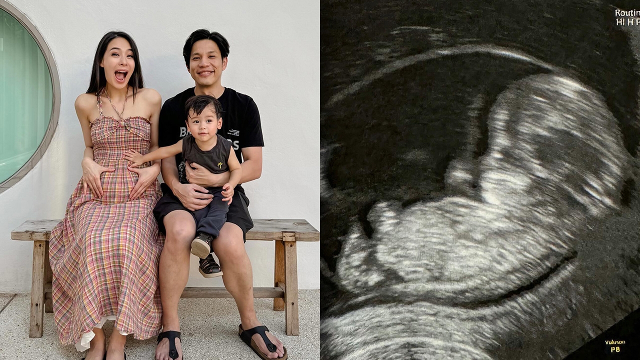 รถเมล์ คะนึงนิจ แจ้งข่าวดีตั้งท้องลูกคนที่ 2 แต่มีภาวะแท้งคุกคาม