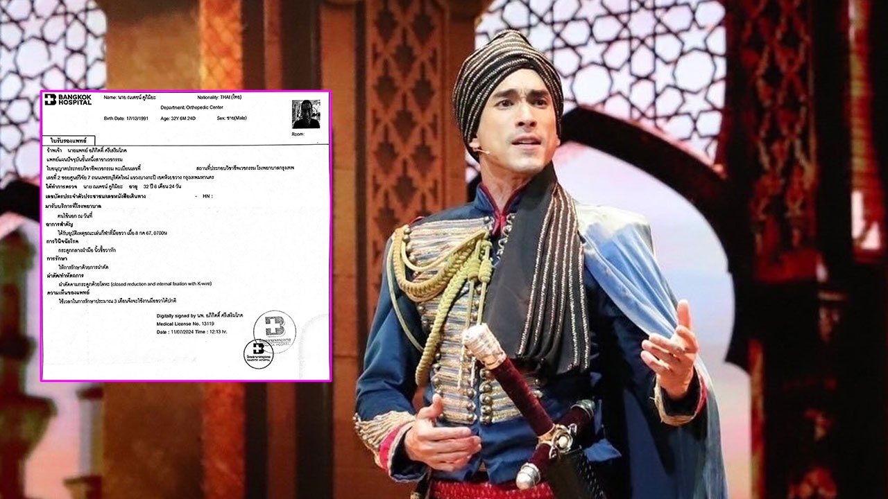 ณเดชน์ อัปเดตอาการ กระดูกกลางฝ่ามือนิ้วชี้ขวาหัก ต้องรักษา 3 เดือน