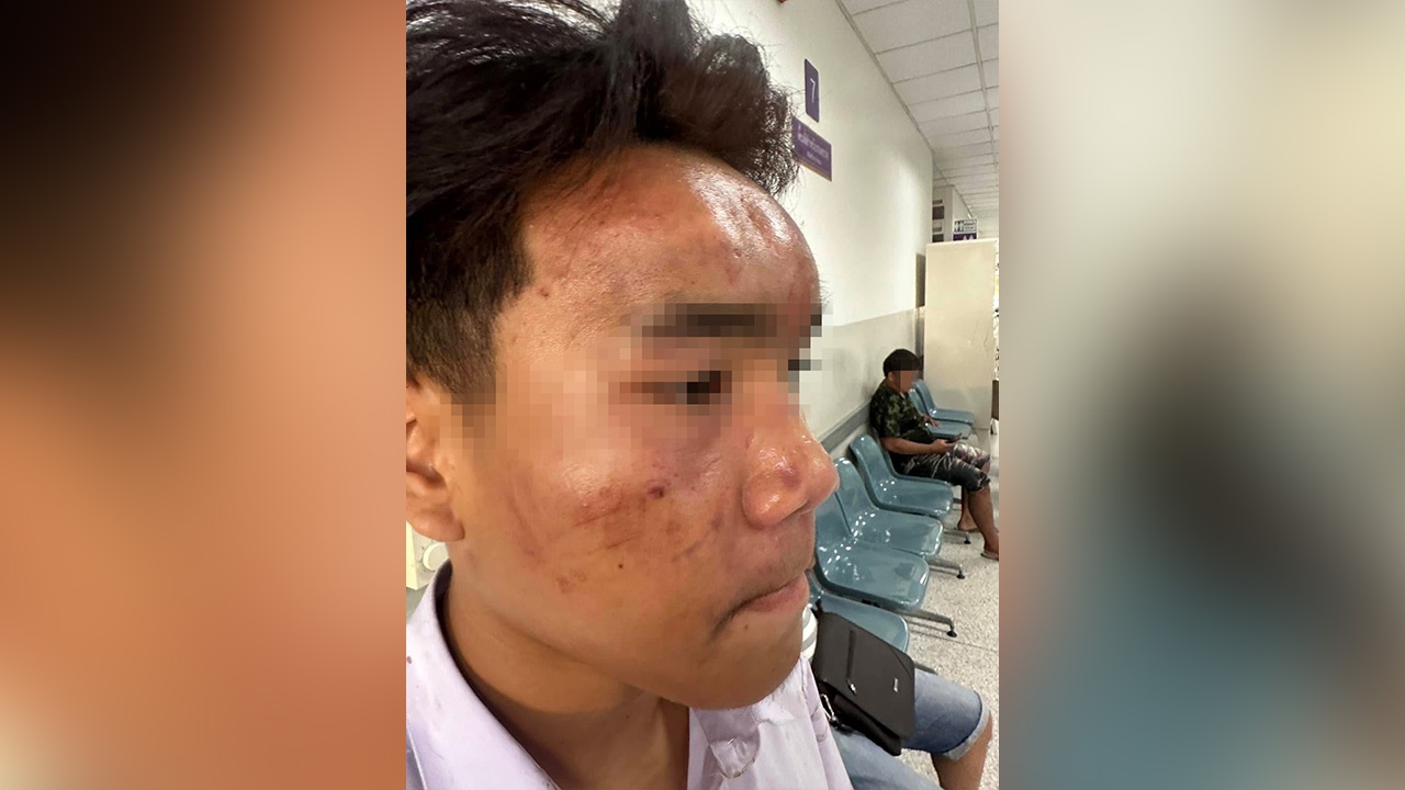 นักบอล ร.ร.ดังโคราช ย้ายมาใหม่ เจอรุ่นพี่ขาใหญ่รับน้องหน้าตาปูด 