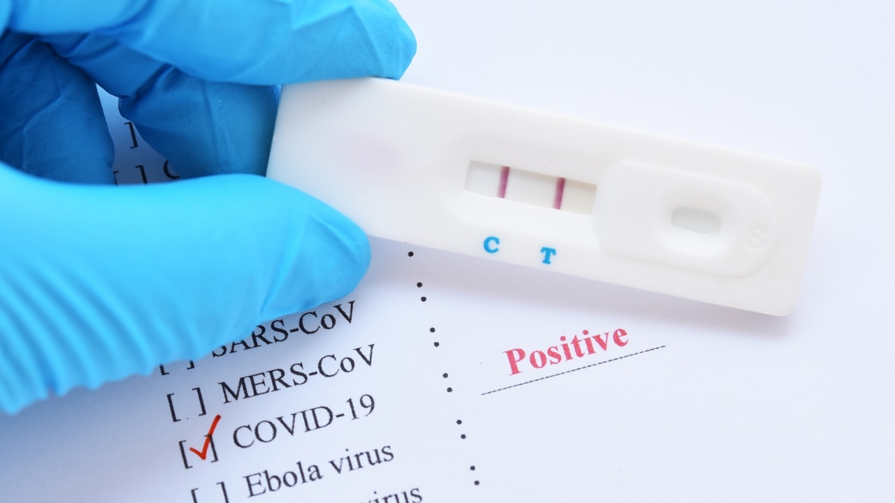 "หมอธีระ" คาด โควิดสายพันธุ์ EG.5.1 อาจระบาดช่วงปลายปี การจัดหาวัคซีนจำเป็นมาก