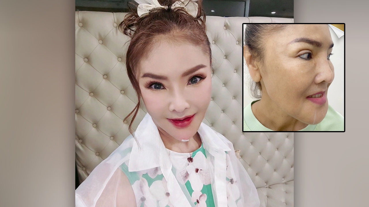 เดือดสนั่น ดาว มยุรี ถูกบูลลี่แรง ศัลยกรรมหน้าจากผี จนเป็นตุ๊กตายาง 