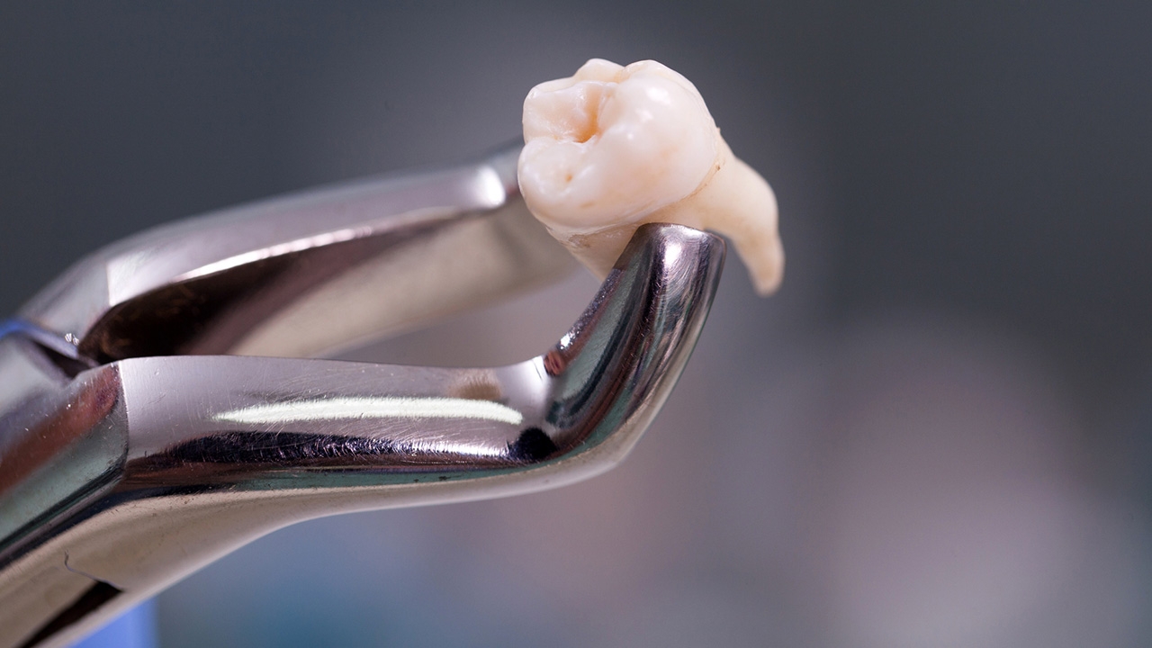 สตาร์ตอัพญี่ปุ่นพัฒนายา ช่วยฟันงอกใหม่