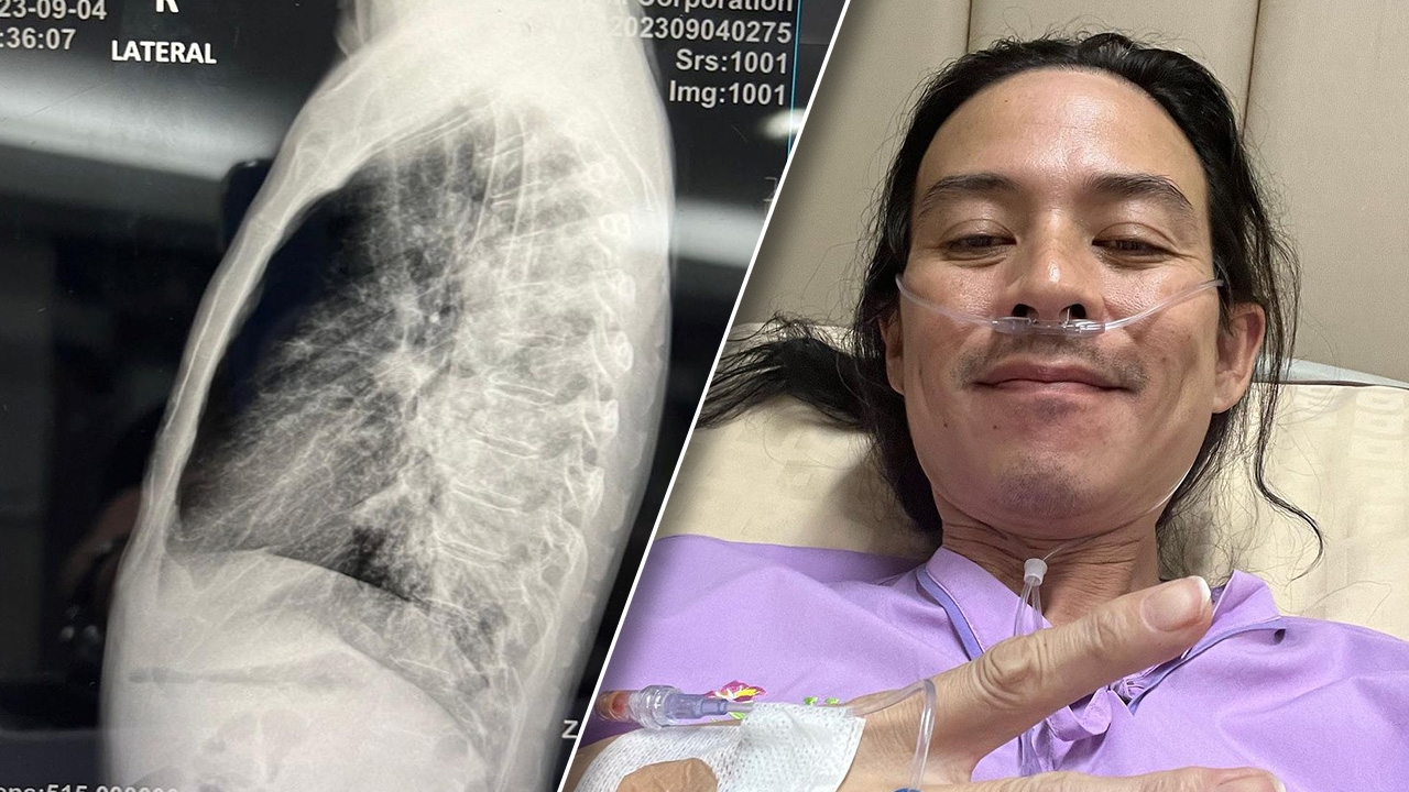 จั๊ก ชวิน ป่วยติดเชื้อวัณโรค ต้องยกเลิกงาน แฟนๆ ส่งกำลังใจให้ล้นหลาม 