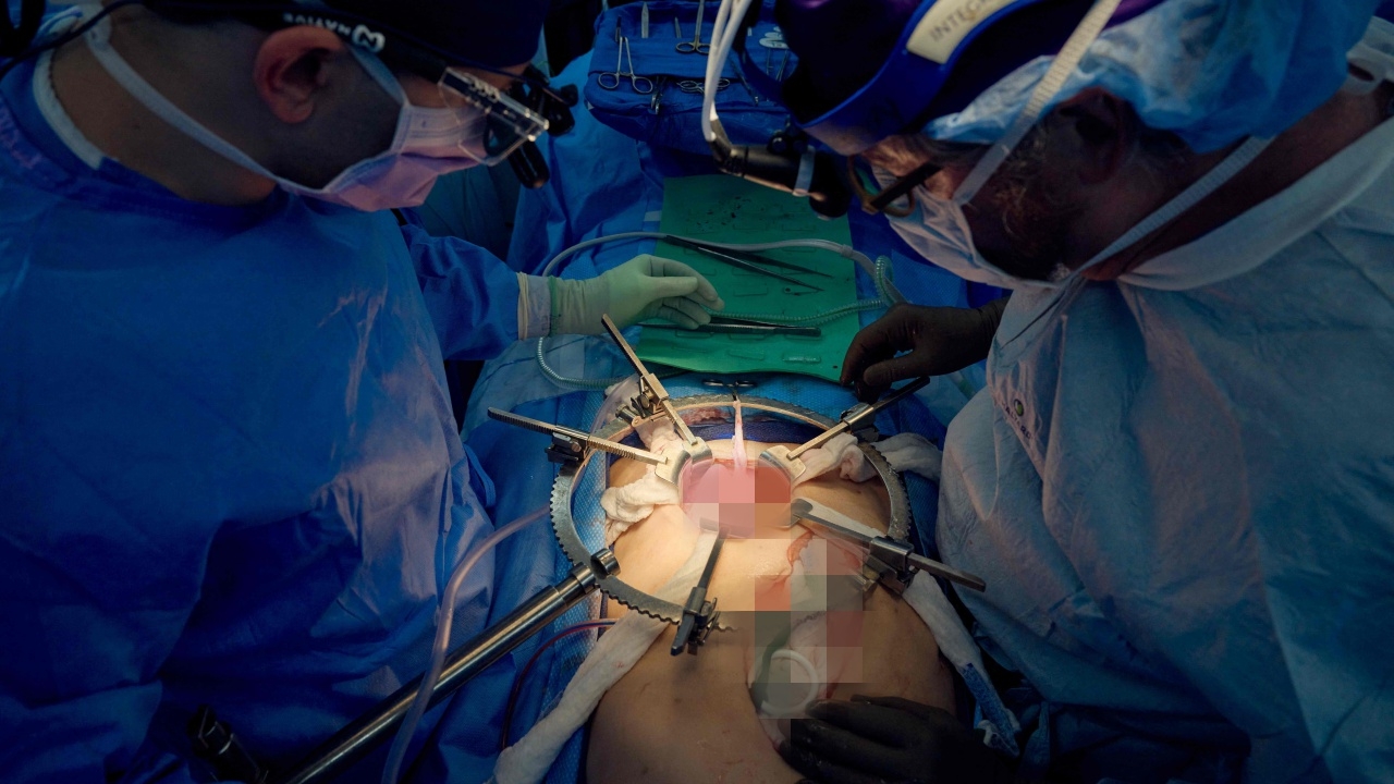 แพทย์อเมริกันปลูกถ่ายหัวใจหมูให้คนเป็นรายที่ 2 ของโลก