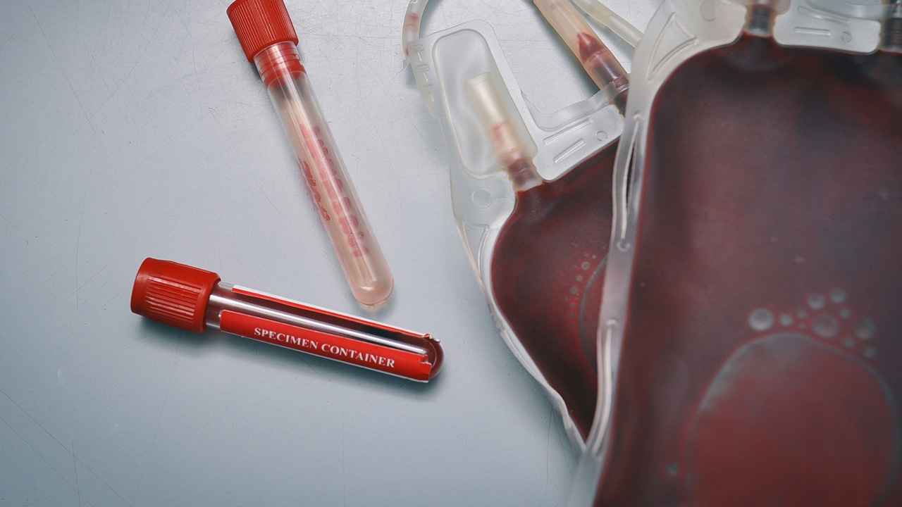 "เลือดหมดคลัง" วิกฤติผู้ป่วยฉุกเฉิน สถิติผู้รับโลหิตปี 66