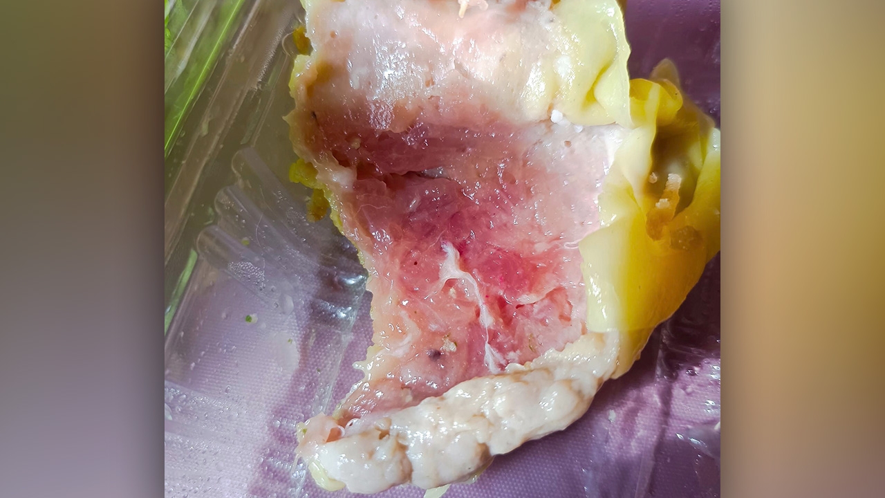 สาวเซ็งหนักมาก ซื้อ "เกี๊ยวหมูปูอัด" ดันได้ "เกี๊ยวหูดับ" อวสานมื้ออร่อย