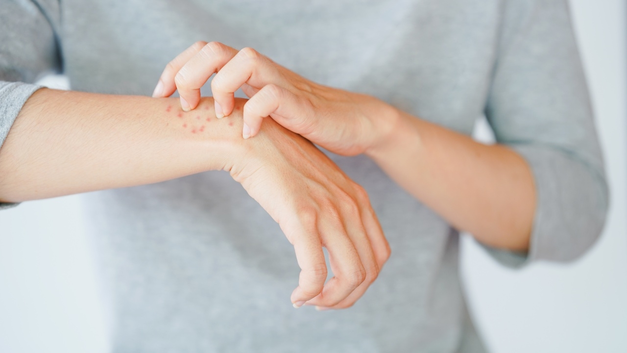 สถาบันโรคผิวหนัง อธิบายชัด "โรคน้ำเหลืองเสีย" ไม่มีอยู่จริงในทางการแพทย์