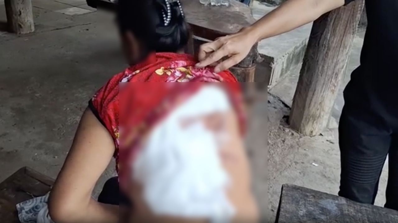 แม่วอนตำรวจจับเข้าคุก ลูกสาวทาสยา โมโหสาดน้ำร้อนใส่ หาว่า หน้าไม่รับแขก