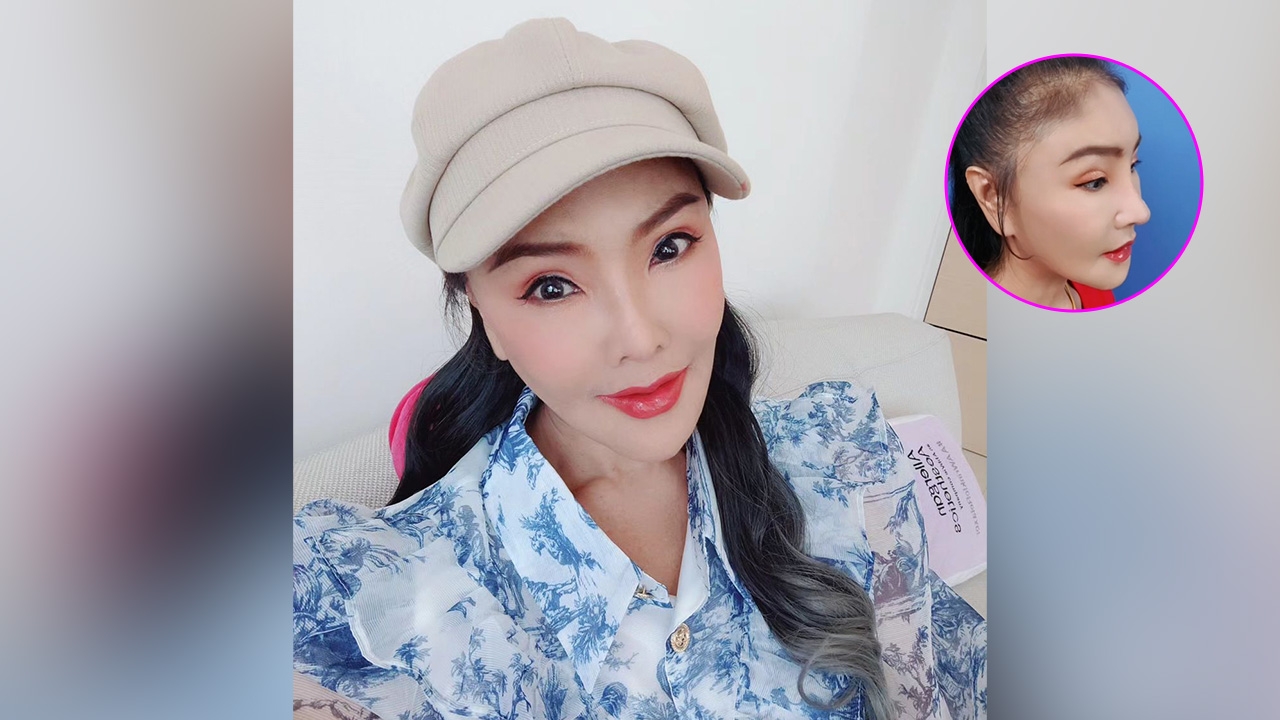 ดาว มยุรี เปิดหน้าหลังทำจมูกใหม่ในรอบ 20 กว่าปี ชาวเน็ตชม สวยปังมาก