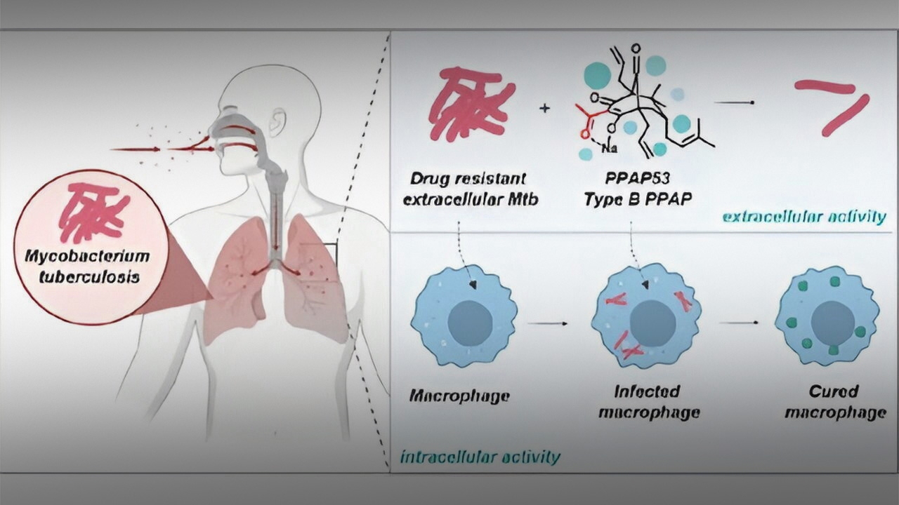 New Breakthrough in Tuberculosis Treatment: PPAP53 Shows Promise in Fighting Drug-Resistant TB