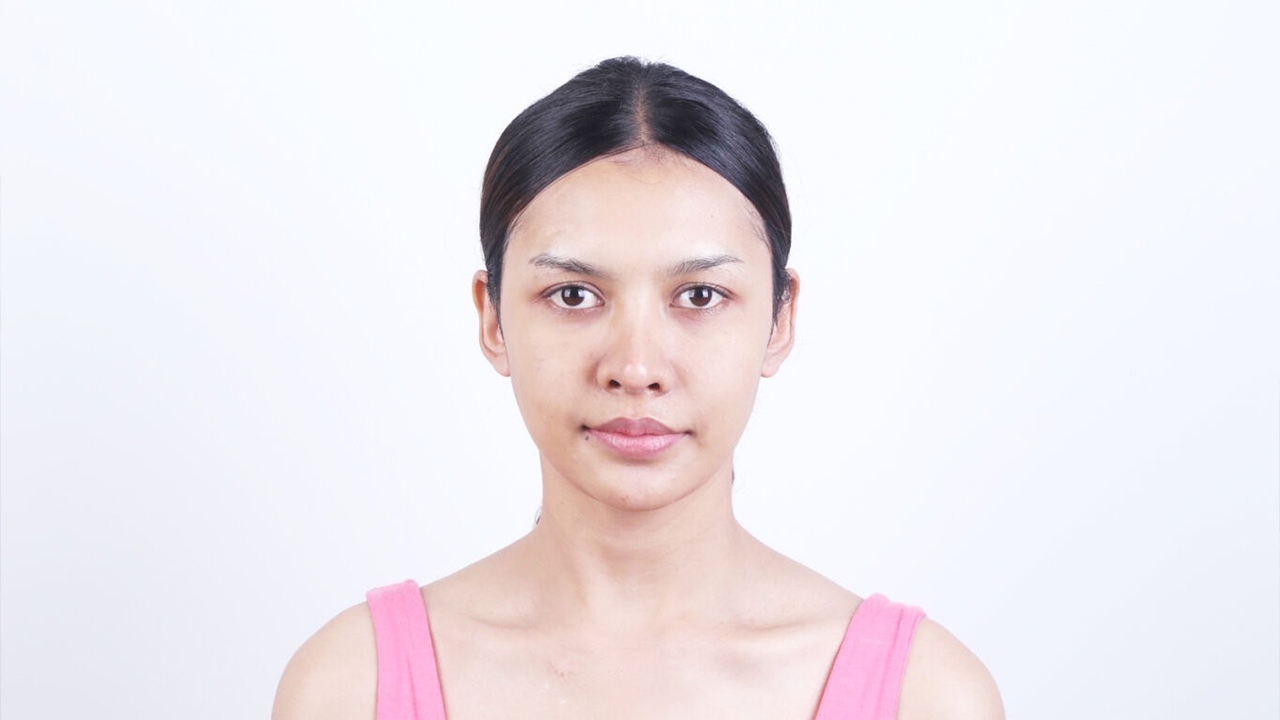 เปิดหน้าล่าสุด ลูกทุ่งดัง เปา กิ่งกาญจน์ ศัลยกรรมหน้าใหม่ งานเข้าทันที