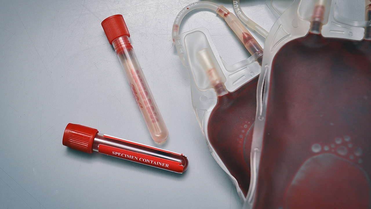 ฝันว่าบริจาคเลือด ฝันว่าบริจาคเลือด 1 ถุง ทำนายฝันได้บริจาคเลือด เลขเด็ด