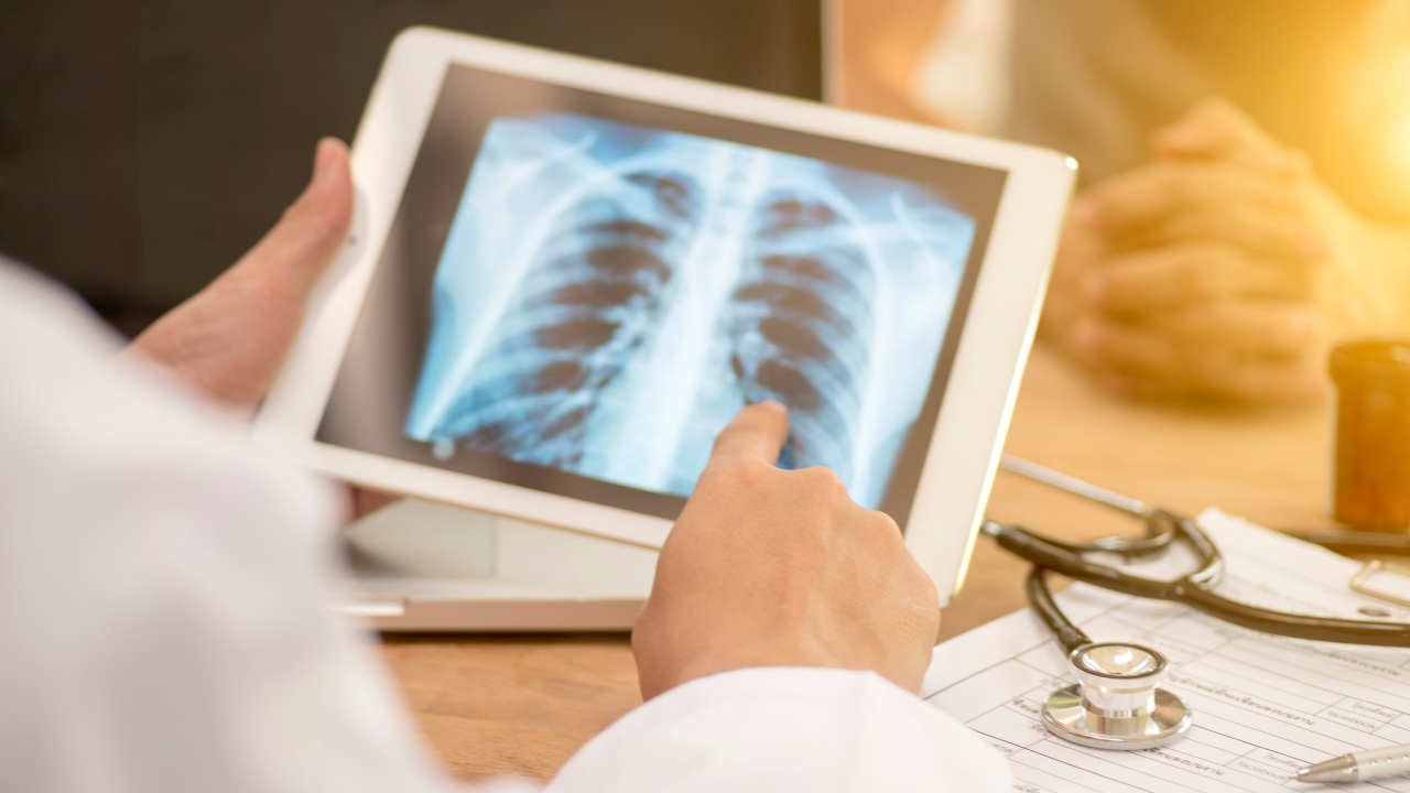 เช็กสัญญาณเตือน "โรคปอดรั่ว" รักษาให้ทัน ป้องกันอันตรายถึงชีวิต