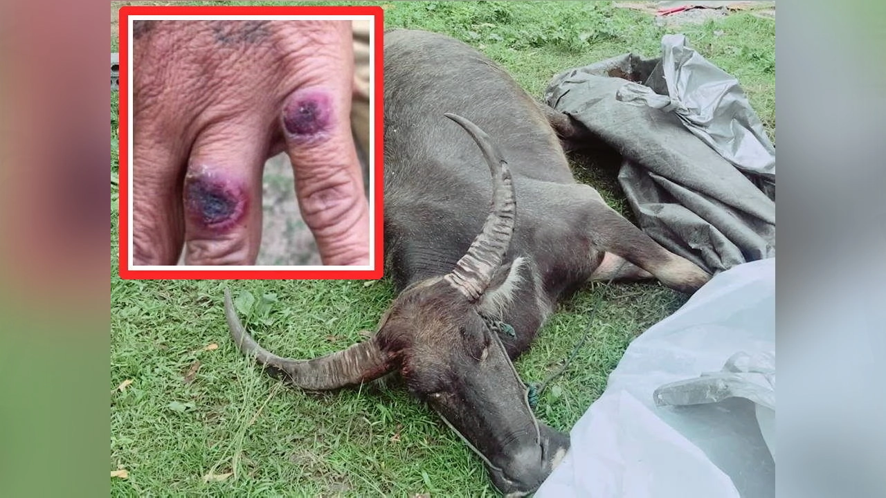 เปิบวัวควายดิบระวังแอนแทรกซ์