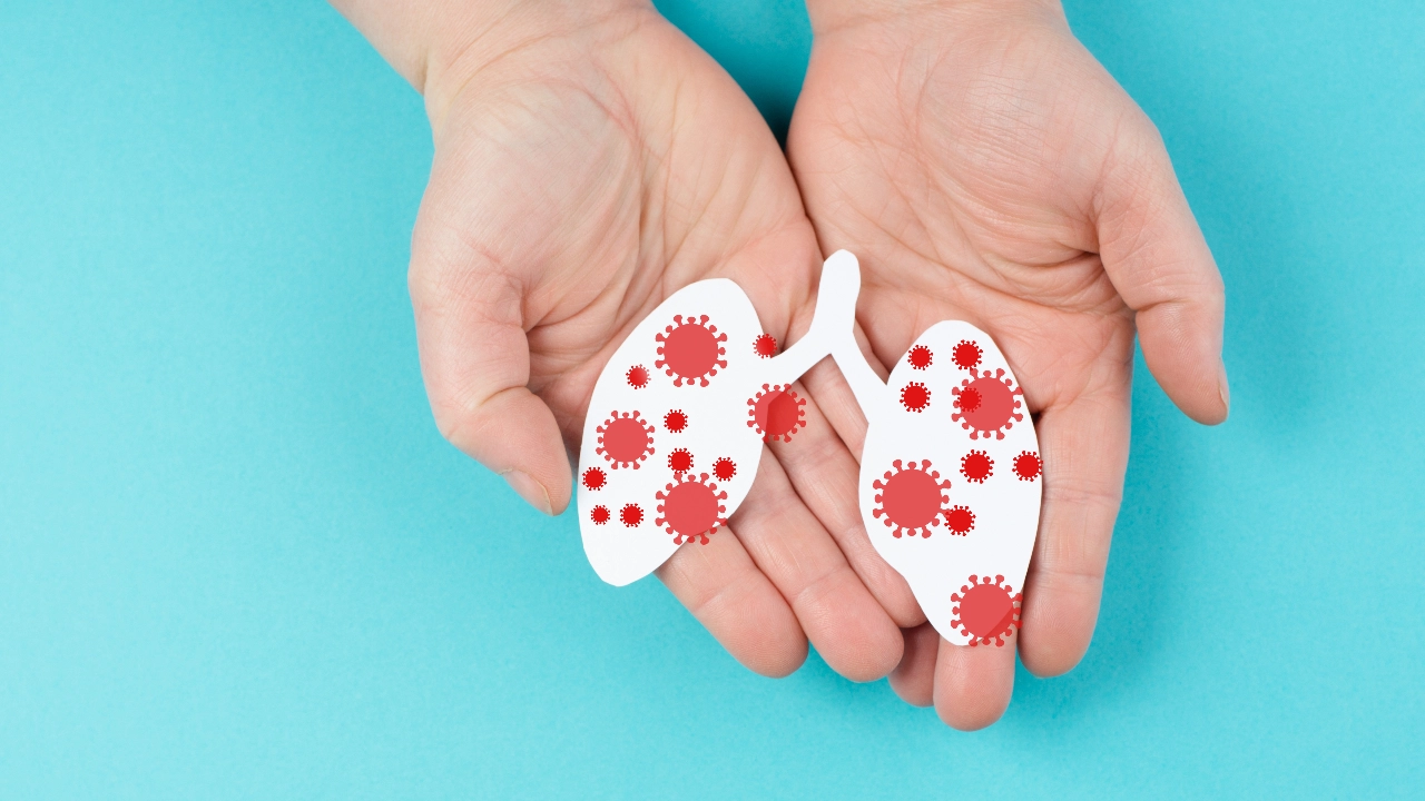 “วัณโรค” ตัวร้าย แม้เป็นได้...ก็หายได้