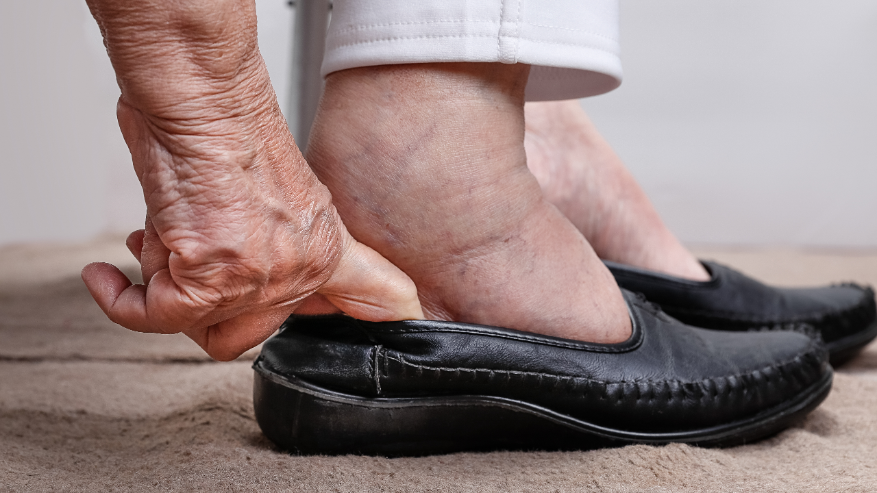 อาการเท้าบวมในผู้สูงอายุ