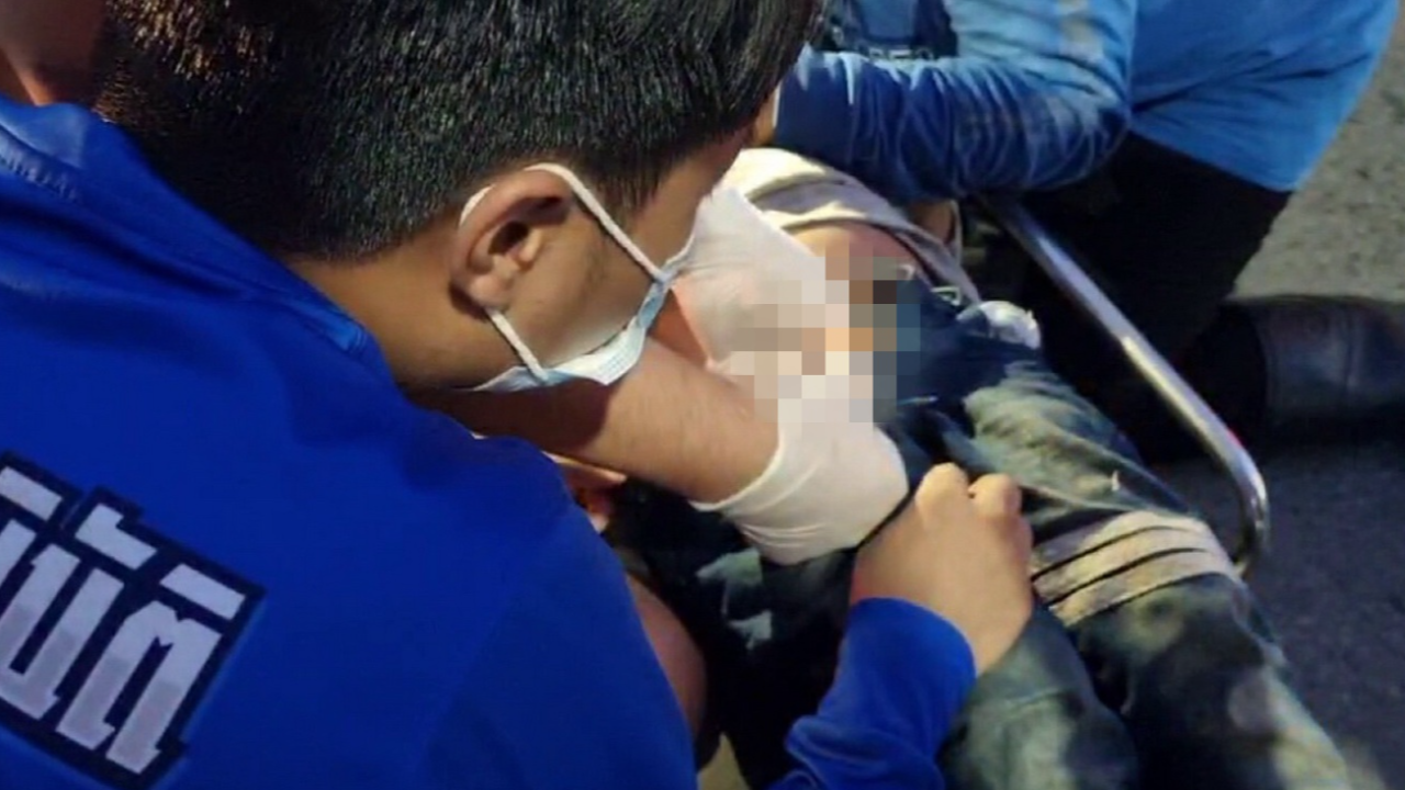 เรื่องใหญ่ ซิปหนีบจู๋ ติดแน่นดึงไม่ออก ด.ช. 8 ขวบร้องลั่น ต้องให้หมอช่วย 