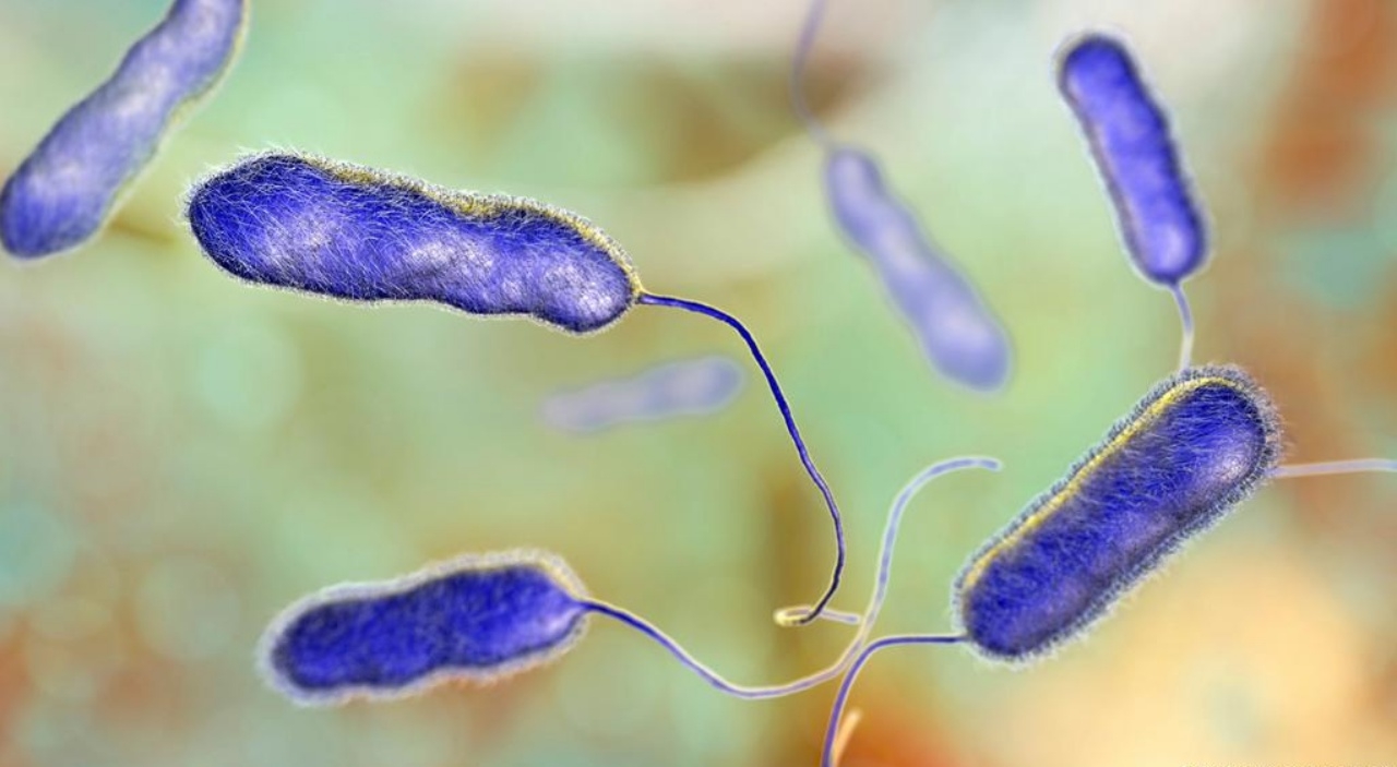 อาร์เจนตินา เผย โรคปอดบวมปริศนา คือโรคลีเจียนแนร์