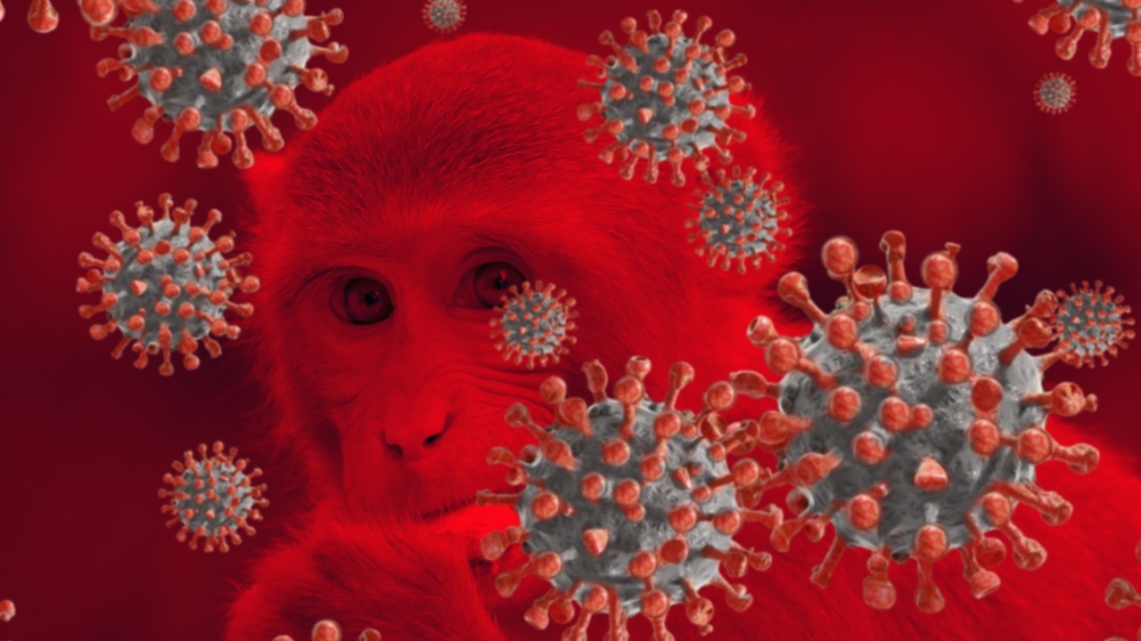 หมอยง เผย คนเคยปลูกฝี สามารถป้องกัน "ฝีดาษลิง" ได้ แม้ตรวจวัดภูมิไม่ขึ้น