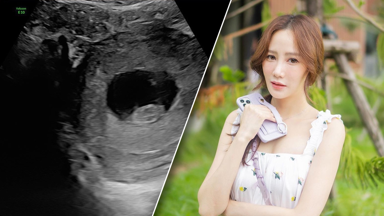 ตาล กัญญา ประกาศข่าวดีท้องแล้ว โชว์ภาพอัลตราซาวนด์ลูกคนแรก