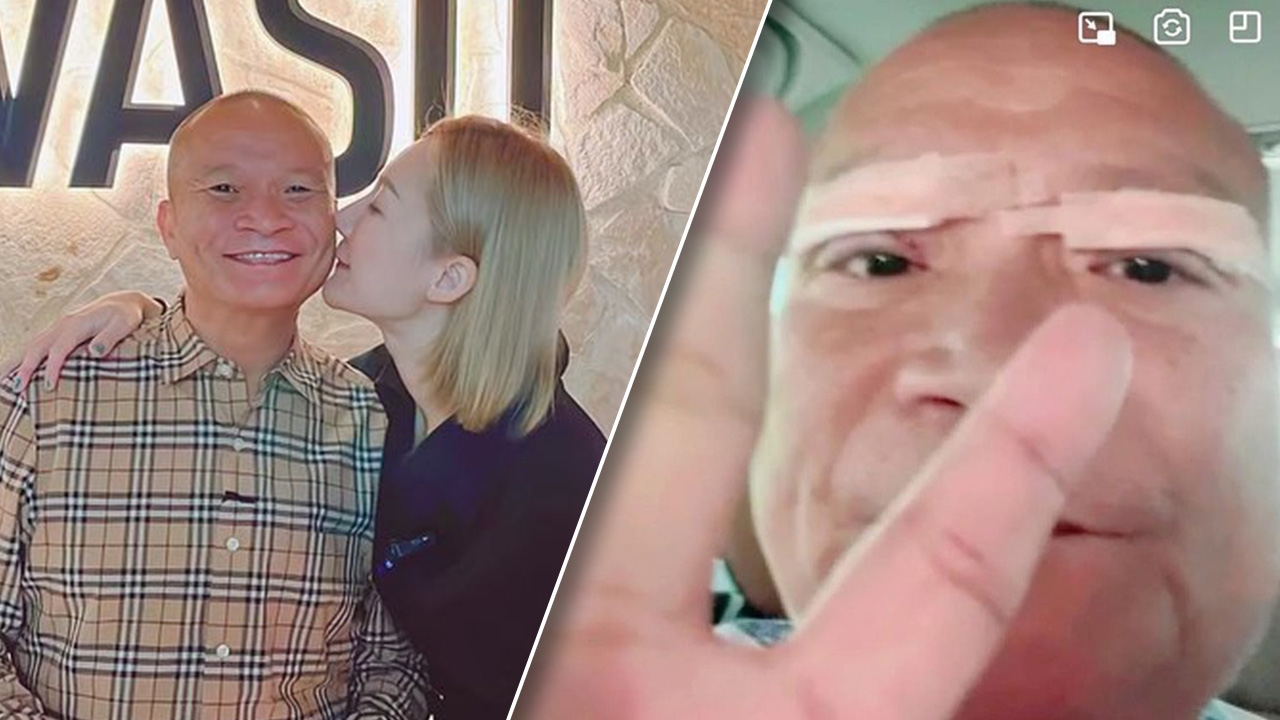 เปิดภาพ หม่ำ จ๊กมก หลังทำศัลยกรรมครั้งแรก ลูกแซวหล่อจนจำใครไม่ได้แล้ว