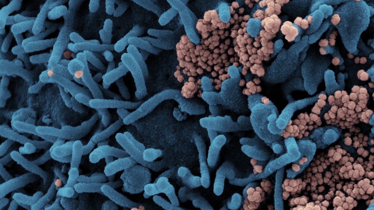 ผวา ผลศึกษาใหม่อังกฤษ พบคนติดโควิด เสี่ยงโรคหัวใจ หลอดเลือด เบาหวาน