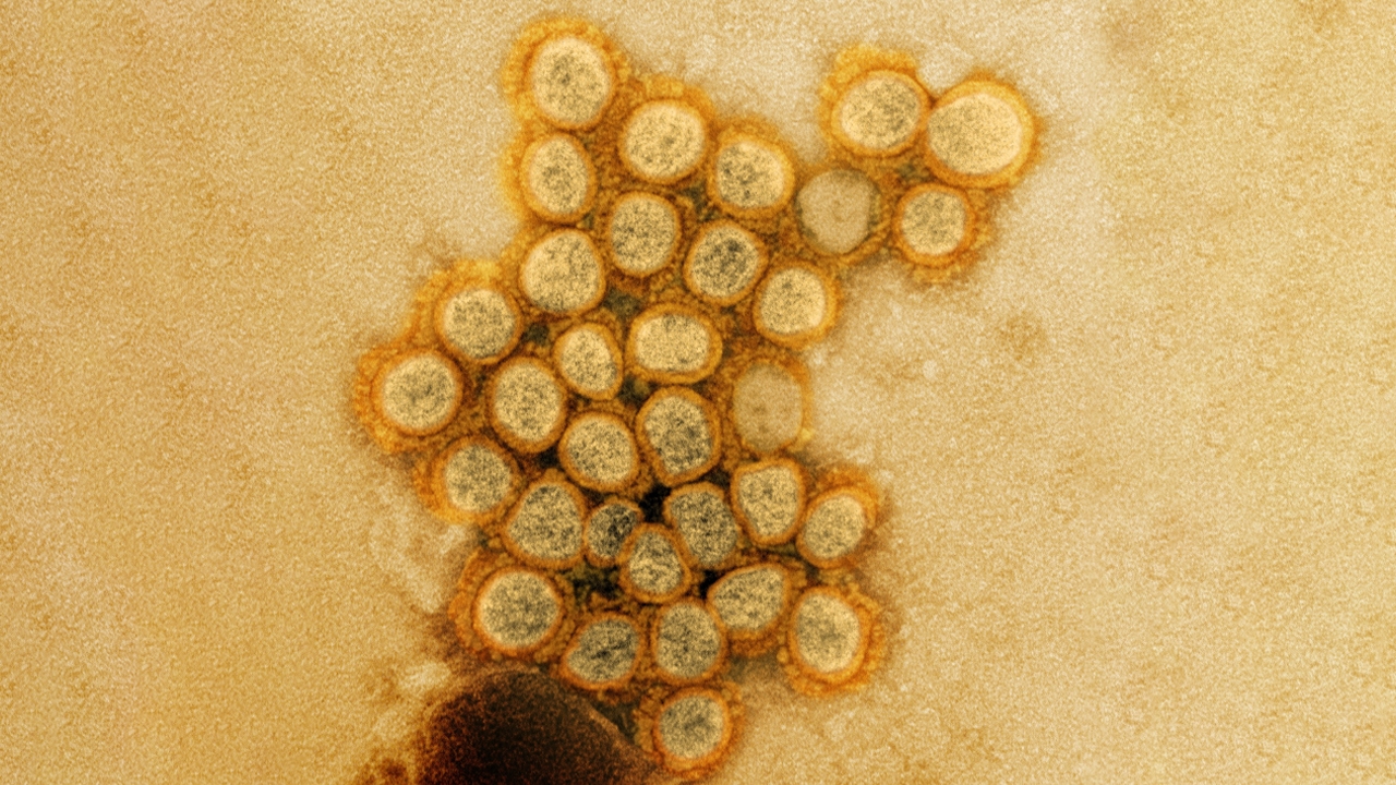 จับตาโอมิครอนชนิดใหม่ ‘BA.2.75’ กลายพันธุ์มากกว่า BA.5 ในไทยก็เจอ