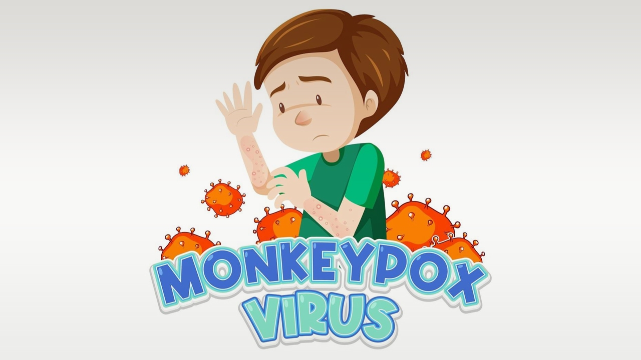 หมอ เผย "ฝีดาษลิง" หายได้เองใน 4 สัปดาห์ รักษาตามอาการ ไม่รุนแรง