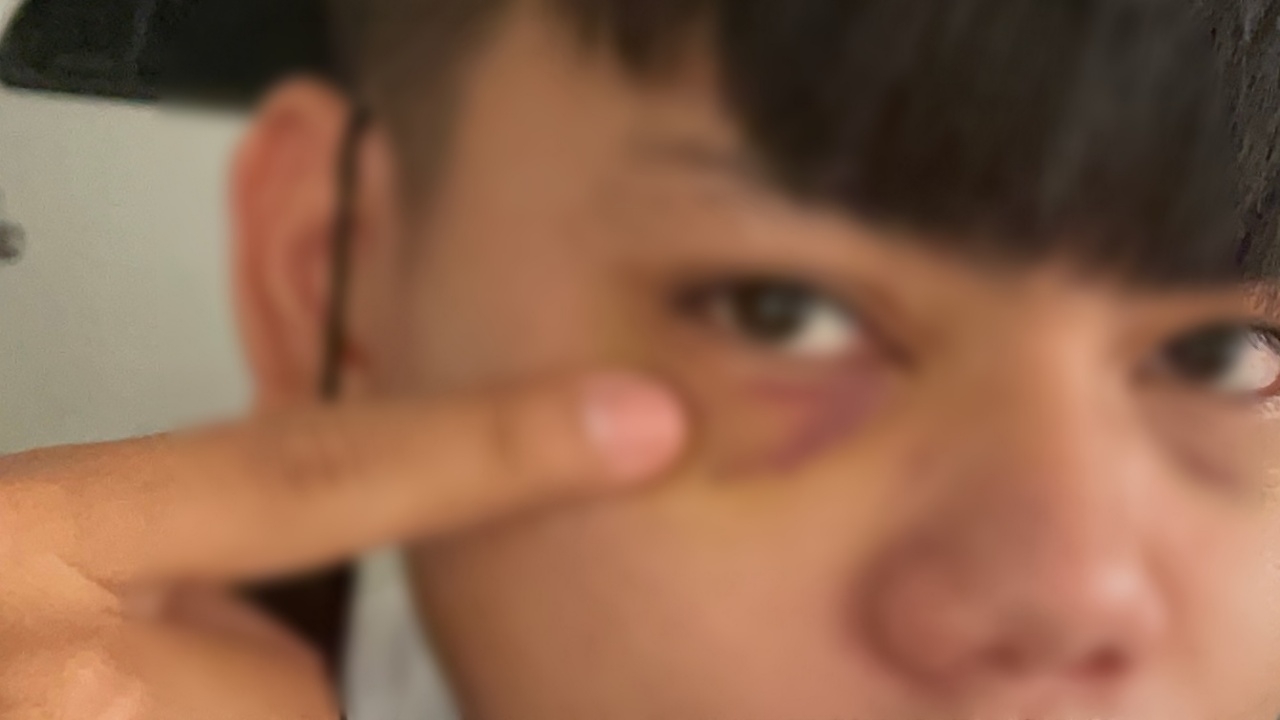 มทร.ธัญบุรี สั่งสอบรุ่นพี่โหด รุมทำร้ายปี 3 รับน้อง-เรียกไปพุ่งหลังตี 4