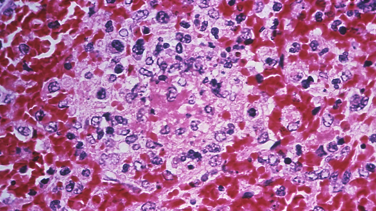 พบต้นตอการระบาด “แบล็กเดธ” ไขปริศนา 700 ปีหายนะเปลี่ยนโลก