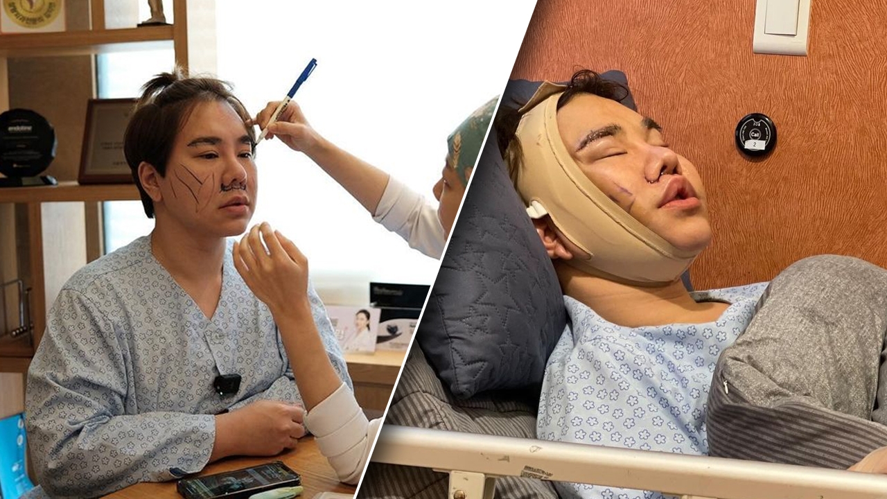 ดีเจบุ๊คโกะ กับวันนี้ที่รอคอย เผยภาพล่าสุดหลังทำหน้าใหม่ที่เกาหลี (คลิป)