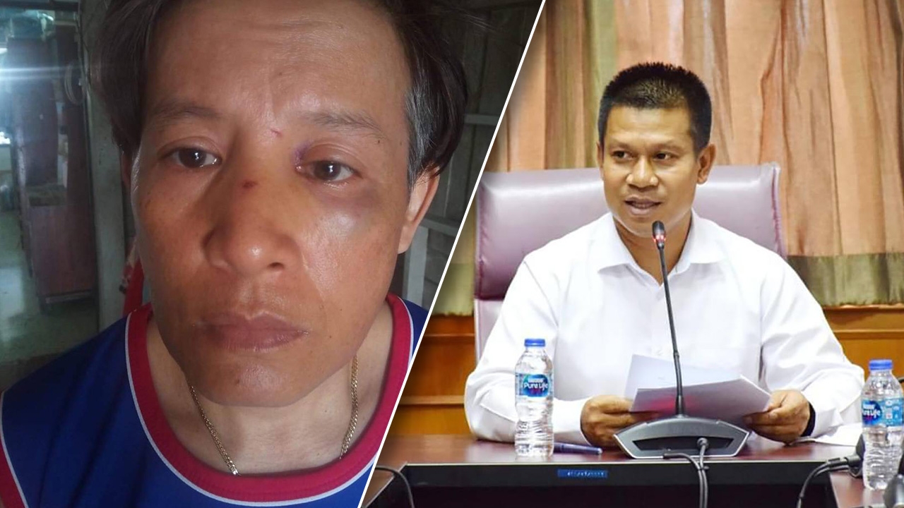  จนท.สาวแจ้งจับ รองนายก อบจ.เมืองคอน “ชกดั้งหัก” ล็อกประตูขัง 