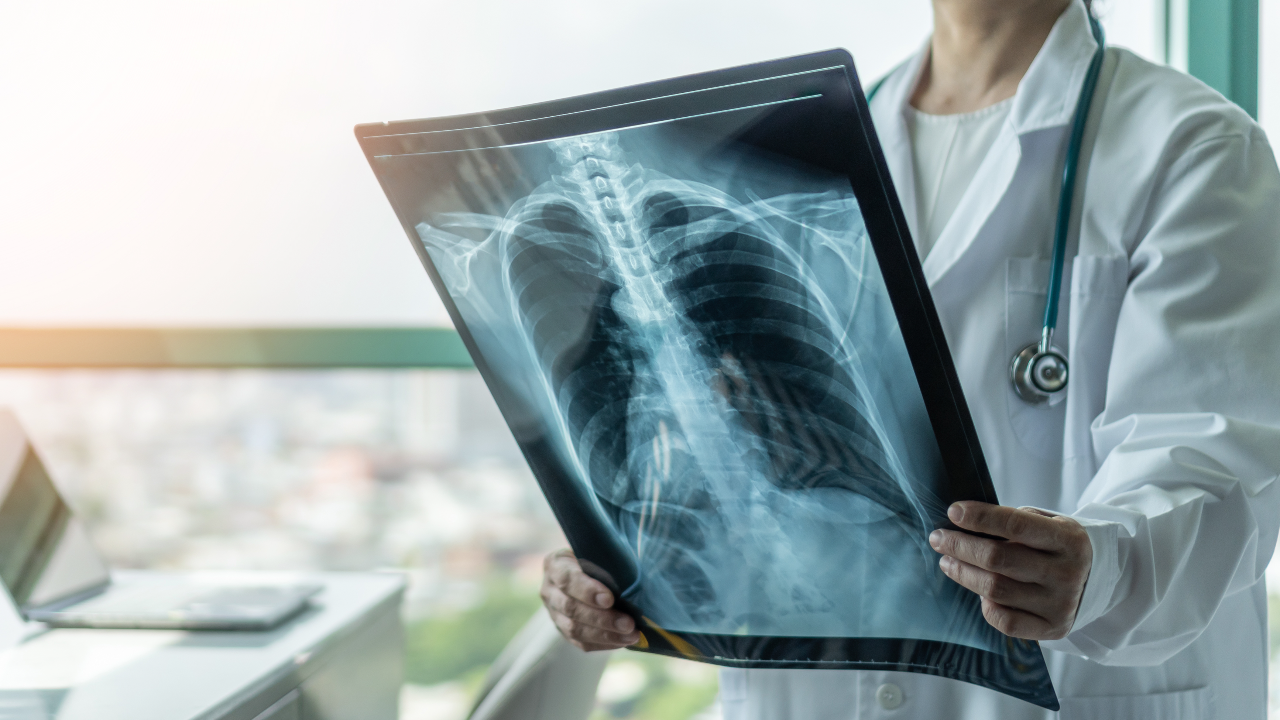 โควิดลงปอดอาการเป็นอย่างไร แนะ 4 วิธีสังเกตอาการตัวเอง