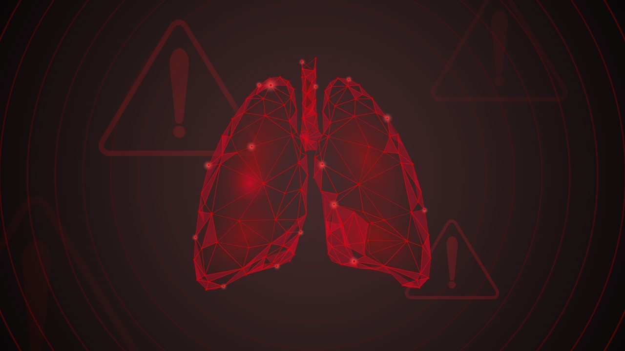 ป่วย "มะเร็งปอด" หรือ "วัณโรค" แค่เอกซเรย์ประจำปีไม่พอ เจออีกทีอาจลามแล้ว