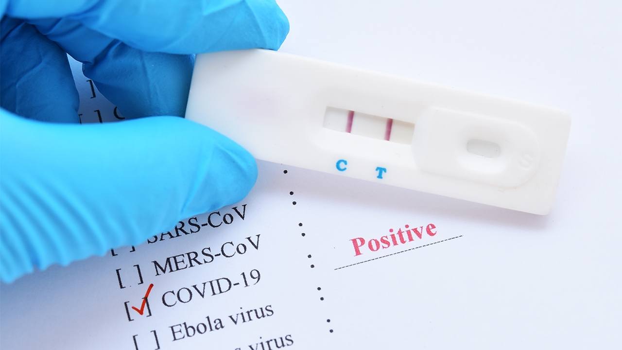 ผู้ติดเชื้อใหม่ รายวันลดลง น้อยกว่า 2 พัน ครั้งแรกปี 65 ดร.เอ้ไม่รอด