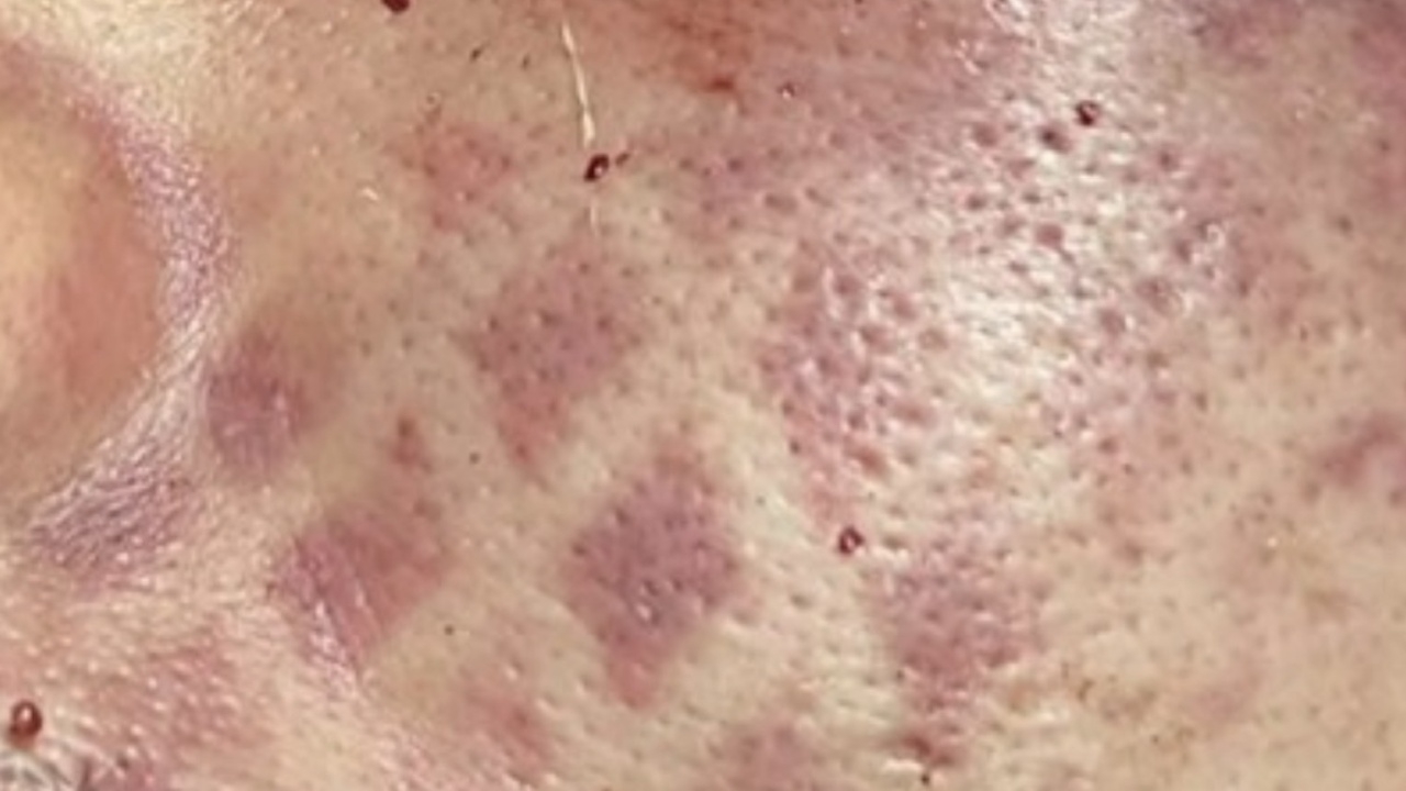 วัยรุ่นรุมยำหนุ่มลี้ปางตาย จนหน้าเป็นรอยรองเท้า ตำรวจเร่งเช็กวงจรปิด