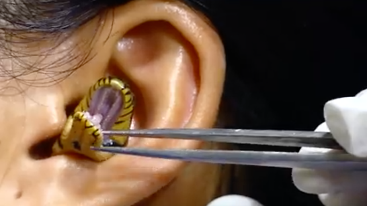 ผู้เชี่ยวชาญวิเคราะห์ "คลิปงูเข้าหู" เรื่องจริง หรือลวงโลก พบพิรุธหลายจุด 