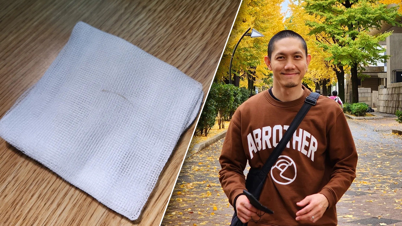 อุทาหรณ์กินปลา ปั๊บ โปเตโต้ เจอก้างติดคอ ต้องโดนล้วงลึกสุดชีวิต